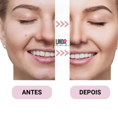 Máscara Facial Argila Rosa Sakura -  Limpa e hidrata profundamente a pele